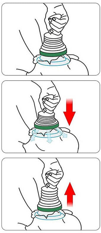 Reddingsset tegen verstikking