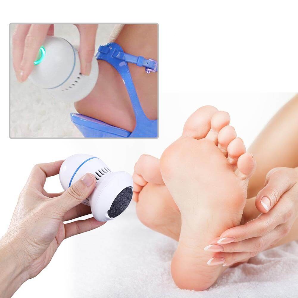 Elektrische Voetverwijderaar voor eelt