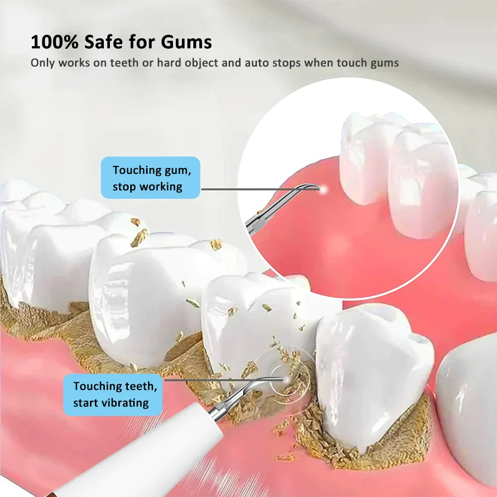 Ultraschall Tandreiniger Wit Kunststof Roestvrij Staal Effectieve Plaque Verwijderaar-2