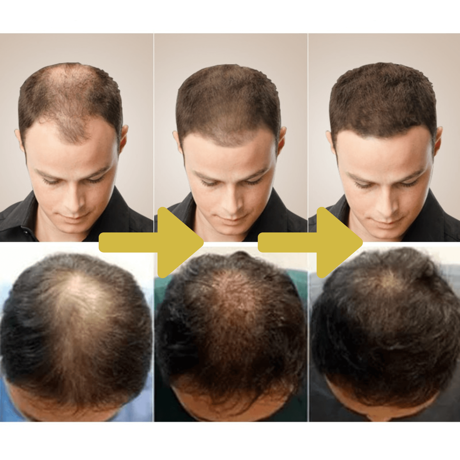 Natuurlijke Gember Haargroeiolie