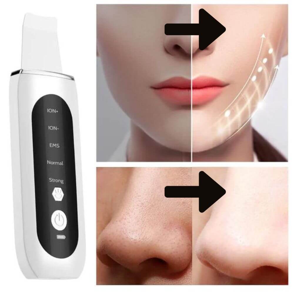 Ultrasonische Gezichtsschraper