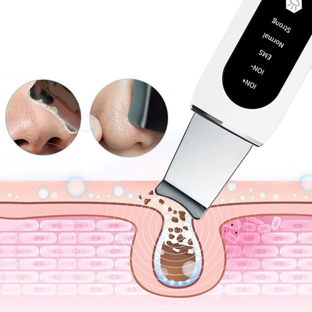 Ultrasonische Gezichtsschraper