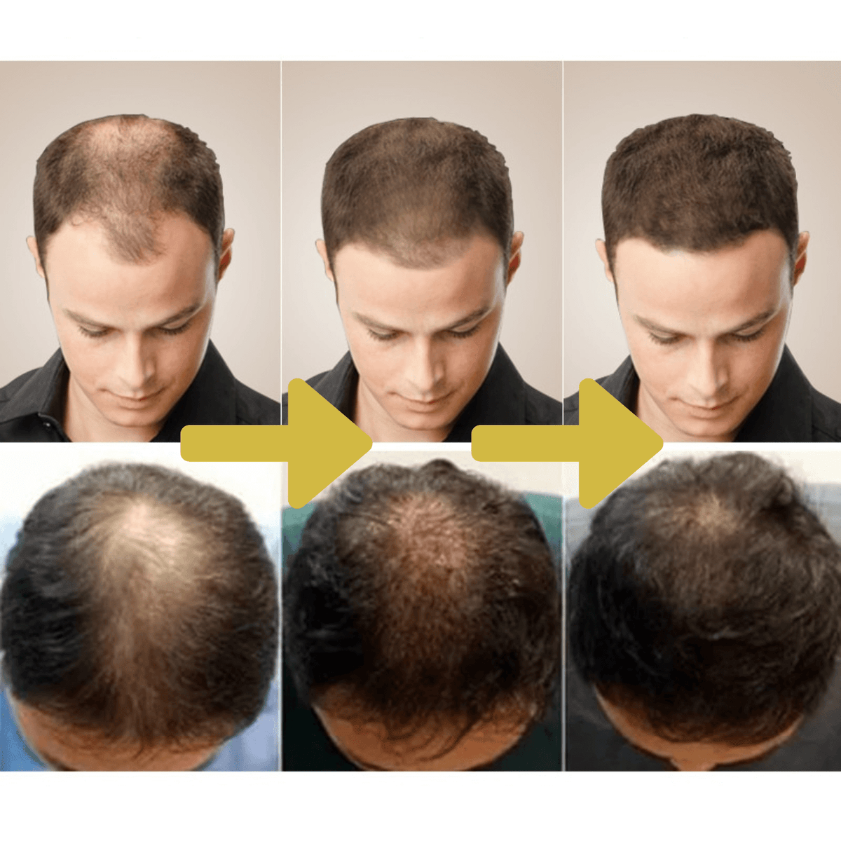 Natuurlijke Gember Haargroeiolie