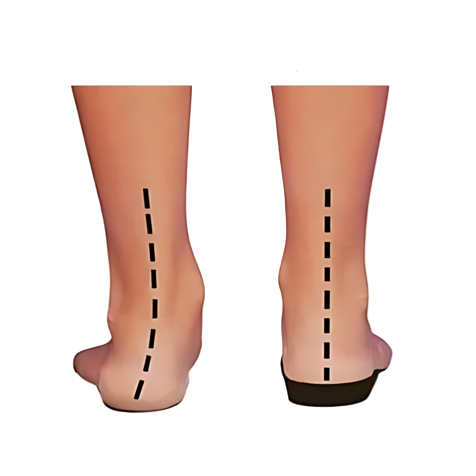 Dames Sneakers met Orthopedische Ondersteuning 2