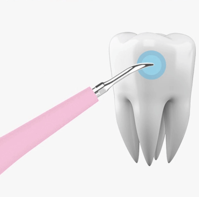 Draagbare Tandsteenverwijderaar